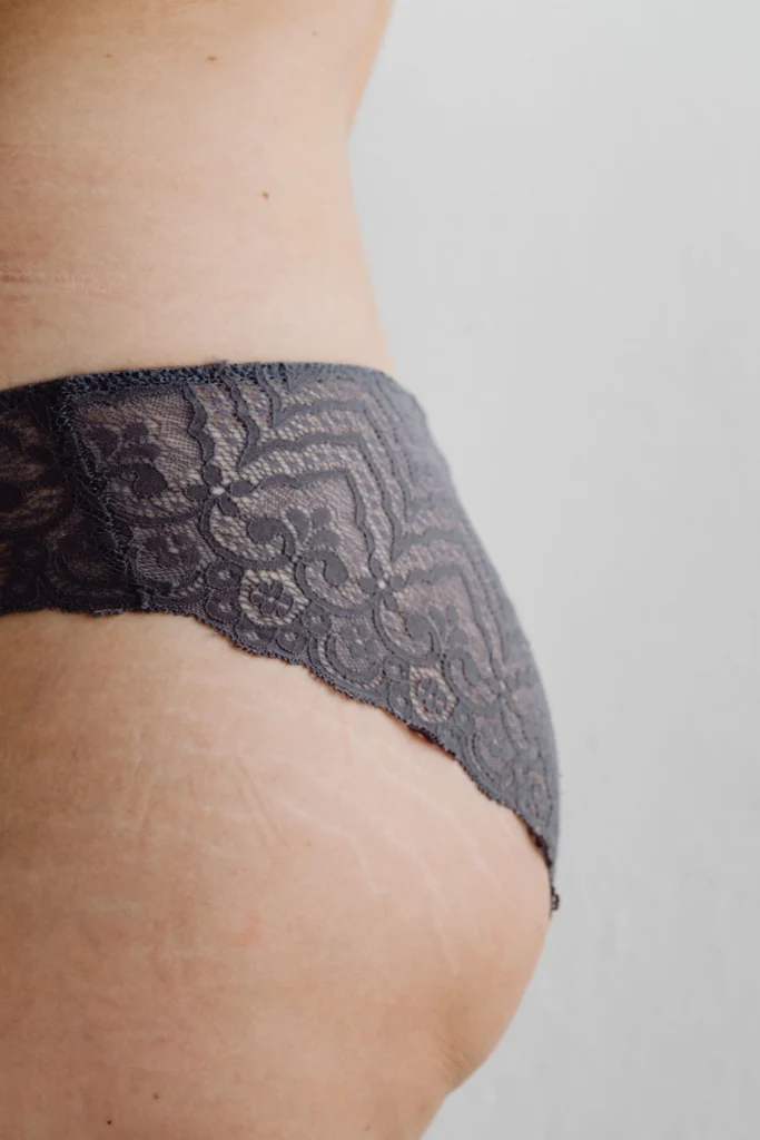 cellulite fesse drainage