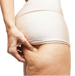 cellulite.fesse drainage.webp